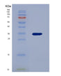 SDS-PAGE analysis of Human FOLR1 (Folate Receptor Alpha) - Recombinant Protein, showing >85% purity under 15% SDS-PAGE (Reduced)