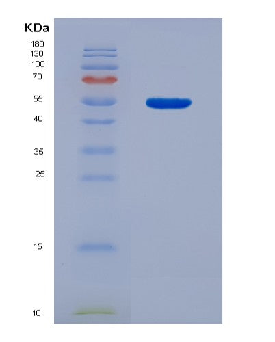 SDS-PAGE analysis of Human SIRPB1 (Signal-Regulatory Protein Beta-1) - Recombinant Protein, showing >90% purity under 15% SDS-PAGE (Reduced)