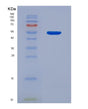 SDS-PAGE analysis of Human SIRPB1 (Signal-Regulatory Protein Beta-1) - Recombinant Protein, showing >90% purity under 15% SDS-PAGE (Reduced)