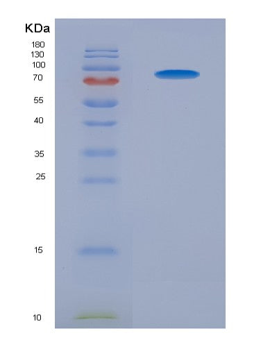 SDS-PAGE analysis of Human TYRO3 (Tyrosine-Protein Kinase Receptor Tyro3) - Recombinant Protein, showing >90% purity under 15% SDS-PAGE (Reduced)