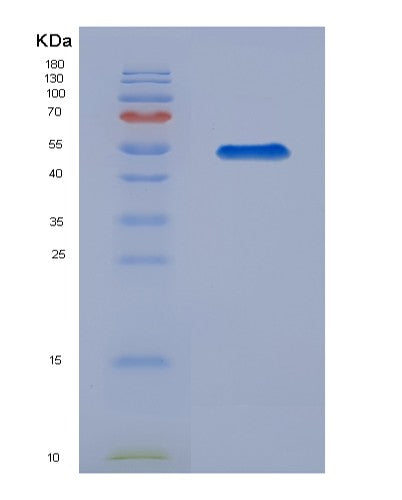 SDS-PAGE analysis of Human TPBG (Trophoblast Glycoprotein) - Recombinant Protein, showing >90% purity under 15% SDS-PAGE (Reduced)
