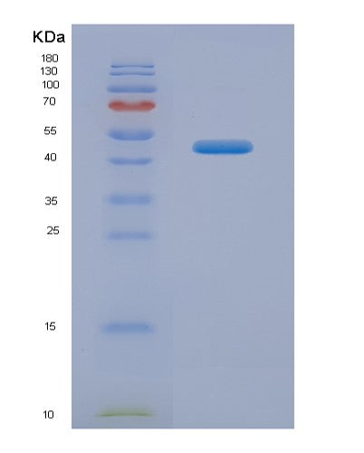 SDS-PAGE analysis of Human BTLA (B- And T-Lymphocyte Attenuator) - Recombinant Protein, showing >90% purity under 15% SDS-PAGE (Reduced)