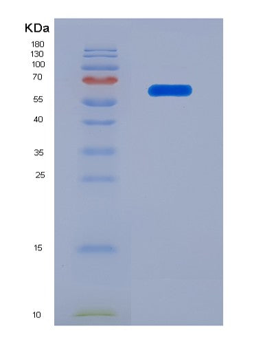 SDS-PAGE analysis of Human IGFBP2 (Insulin-Like Growth Factor-Binding Protein 2) - Recombinant Protein, showing >90% purity under 15% SDS-PAGE (Reduced)