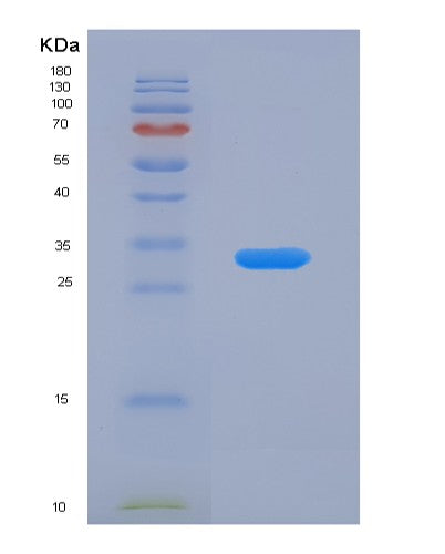 SDS-PAGE analysis of Human ANGPTL4 (Angiopoietin-Related Protein 4) - Recombinant Protein, showing >90% purity under 15% SDS-PAGE (Reduced)