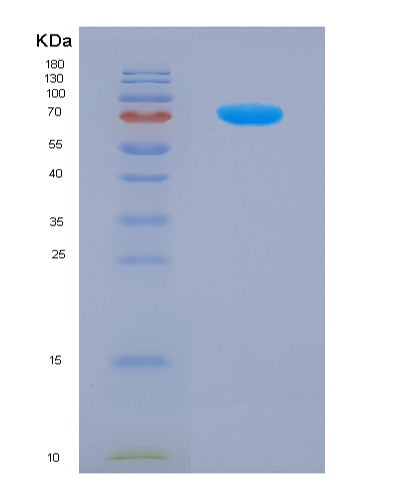 SDS-PAGE analysis of Human CD46 (Membrane Cofactor Protein) - Recombinant Protein, showing >85% purity under 15% SDS-PAGE (Reduced)