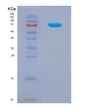 SDS-PAGE analysis of Human CD46 (Membrane Cofactor Protein) - Recombinant Protein, showing >85% purity under 15% SDS-PAGE (Reduced)