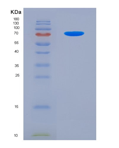 SDS-PAGE analysis of Human CD72 (B-Cell Differentiation Antigen Cd72) - Recombinant Protein, showing >90% purity under 15% SDS-PAGE (Reduced)