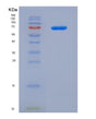 SDS-PAGE analysis of Human GDNF (Glial Cell Line-Derived Neurotrophic Factor) - Recombinant Protein, showing >95% purity under 15% SDS-PAGE (Reduced)