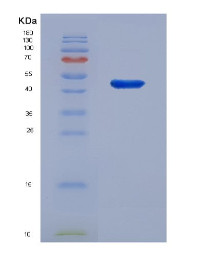 SDS-PAGE analysis of Human TNFRSF25 (Tumor Necrosis Factor Receptor Superfamily Member 25) - Recombinant Protein, showing >95% purity under 15% SDS-PAGE (Reduced)