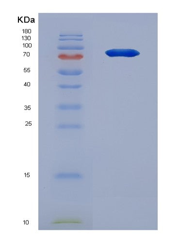 SDS-PAGE analysis of Human CSF3R (Granulocyte Colony-Stimulating Factor Receptor) - Recombinant Protein, showing >90% purity under 15% SDS-PAGE (Reduced)