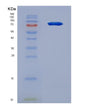 SDS-PAGE analysis of Human CSF3R (Granulocyte Colony-Stimulating Factor Receptor) - Recombinant Protein, showing >90% purity under 15% SDS-PAGE (Reduced)
