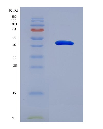SDS-PAGE analysis of Human PDGFC (Platelet-Derived Growth Factor C) - Recombinant Protein, showing >90% purity under 15% SDS-PAGE (Reduced)