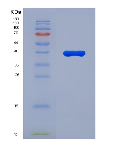 SDS-PAGE analysis of Human DSG1 (Desmoglein-1) - Recombinant Protein, showing >90% purity under 15% SDS-PAGE (Reduced)