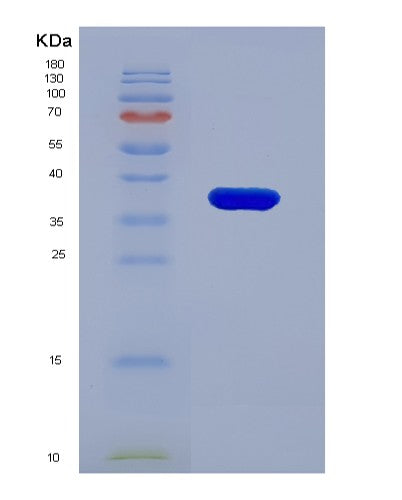 SDS-PAGE analysis of Human DSG2 (Desmoglein-2) - Recombinant Protein, showing >90% purity under 15% SDS-PAGE (Reduced)