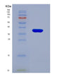 SDS-PAGE analysis of Human DSG2 (Desmoglein-2) - Recombinant Protein, showing >90% purity under 15% SDS-PAGE (Reduced)