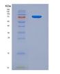 SDS-PAGE analysis of Human IL10RB (Interleukin-10 Receptor Subunit Beta) - Recombinant Protein, showing >85% purity under 15% SDS-PAGE (Reduced)