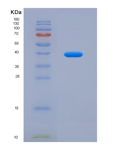 SDS-PAGE analysis of Human IL11RA (Interleukin-11 Receptor Subunit Alpha) - Recombinant Protein, showing >95% purity under 15% SDS-PAGE (Reduced)