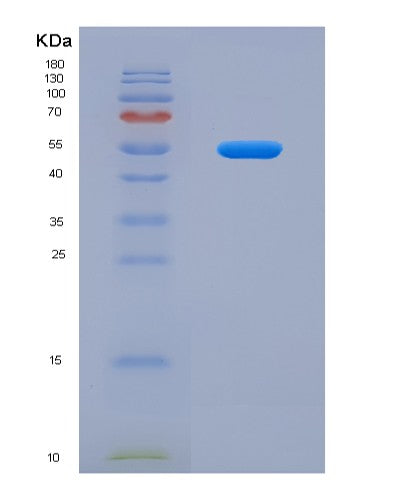 SDS-PAGE analysis of Human CSF2RB (Cytokine Receptor Common Subunit Beta) - Recombinant Protein, showing >95% purity under 15% SDS-PAGE (Reduced)