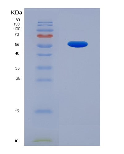 SDS-PAGE analysis of Human TNFRSF10D (Tumor Necrosis Factor Receptor Superfamily Member 10D) - Recombinant Protein, showing >85% purity under 15% SDS-PAGE (Reduced)