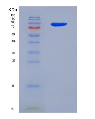 SDS-PAGE analysis of Human POSTN (Periostin) - Recombinant Protein, showing >95% purity under 15% SDS-PAGE (Reduced)