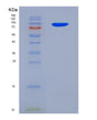 SDS-PAGE analysis of Human POSTN (Periostin) - Recombinant Protein, showing >95% purity under 15% SDS-PAGE (Reduced)