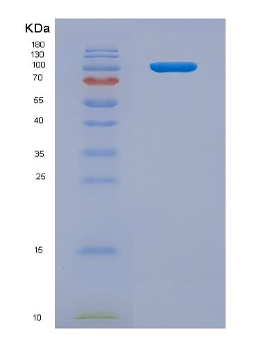 SDS-PAGE analysis of Human IL12RB2 (Interleukin-12 Receptor Subunit Beta-2) - Recombinant Protein, showing >90% purity under 15% SDS-PAGE (Reduced)