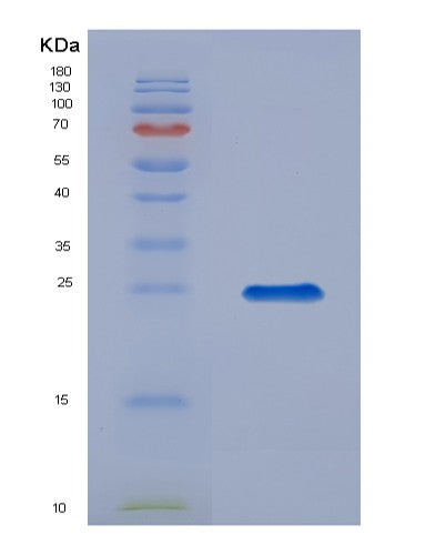 SDS-PAGE analysis of Mouse Tslp (Thymic Stromal Lymphopoietin) - Recombinant Protein, showing >85% purity under 15% SDS-PAGE (Reduced)