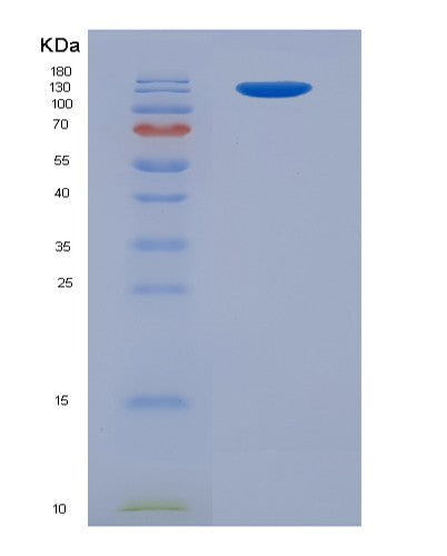 SDS-PAGE analysis of Human IGF2R (Cation-Independent Mannose-6-Phosphate Receptor) - Recombinant Protein, showing >90% purity under 15% SDS-PAGE (Reduced)
