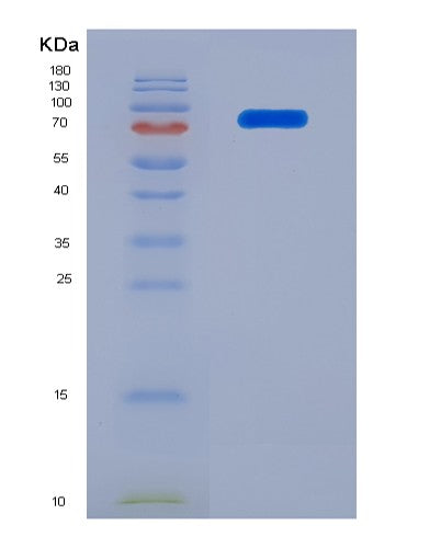 SDS-PAGE analysis of Human TNFRSF21 (Tumor Necrosis Factor Receptor Superfamily Member 21) - Recombinant Protein, showing >90% purity under 15% SDS-PAGE (Reduced)