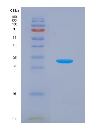 SDS-PAGE analysis of Human TMIGD2 (Transmembrane And Immunoglobulin Domain-Containing Protein 2) - Recombinant Protein, showing >95% purity under 15% SDS-PAGE (Reduced)