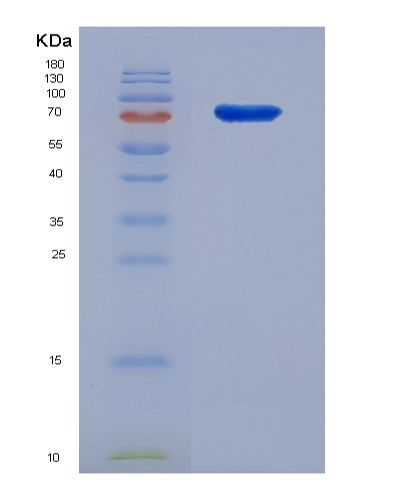 SDS-PAGE analysis of Human IDS (Iduronate 2-Sulfatase) - Recombinant Protein, showing >95% purity under 15% SDS-PAGE (Reduced)