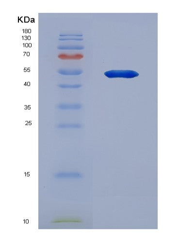 SDS-PAGE analysis of Human SERPINA3 (Alpha-1-Antichymotrypsin) - Recombinant Protein, showing >90% purity under 15% SDS-PAGE (Reduced)
