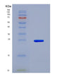 SDS-PAGE analysis of Human FCGR2B (Low Affinity Immunoglobulin Gamma Fc Region Receptor Ii-B) - Recombinant Protein, showing >85% purity under 15% SDS-PAGE (Reduced)