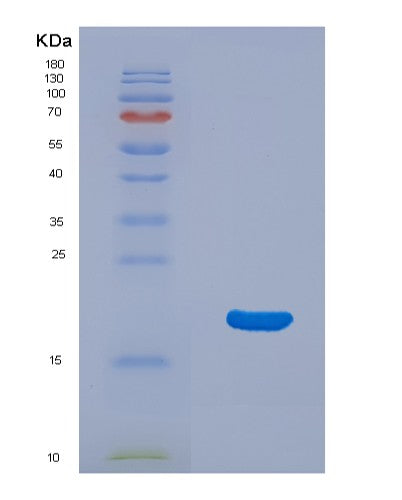 SDS-PAGE analysis of Mouse Il33 (Interleukin-33) - Recombinant Protein, showing >90% purity under 15% SDS-PAGE (Reduced)
