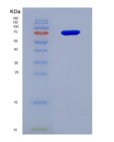 SDS-PAGE analysis of Human CD226 (Cd226 Antigen) - Recombinant Protein, showing >95% purity under 15% SDS-PAGE (Reduced)