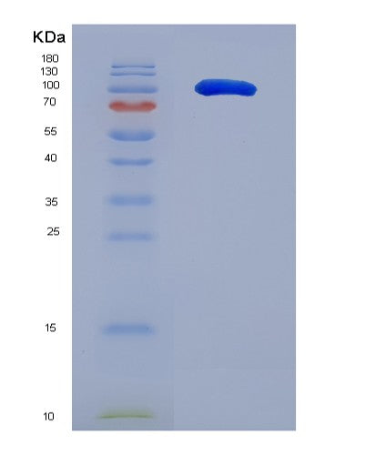 SDS-PAGE analysis of Human ICAM3 (Intercellular Adhesion Molecule 3) - Recombinant Protein, showing >90% purity under 15% SDS-PAGE (Reduced)