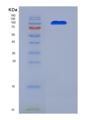 SDS-PAGE analysis of Human CD93 (Complement Component C1Q Receptor) - Recombinant Protein, showing >95% purity under 15% SDS-PAGE (Reduced)