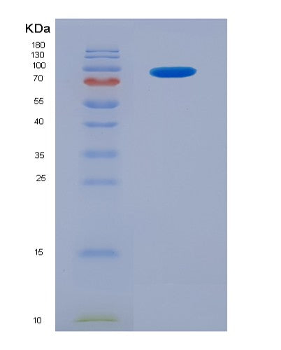 SDS-PAGE analysis of Human SIGLEC5 (Sialic Acid-Binding Ig-Like Lectin 5) - Recombinant Protein, showing >85% purity under 15% SDS-PAGE (Reduced)