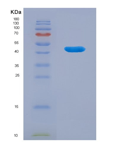 SDS-PAGE analysis of Human CRY1 (Cryptochrome-1) - Recombinant Protein, showing >90% purity under 15% SDS-PAGE (Reduced)