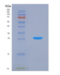 SDS-PAGE analysis of Human DNM1 (Dynamin-1) - Recombinant Protein, showing >90% purity under 15% SDS-PAGE (Reduced)