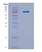SDS-PAGE analysis of Mouse Lgals3bp (Galectin-3-Binding Protein) - Recombinant Protein, showing >90% purity under 15% SDS-PAGE (Reduced)