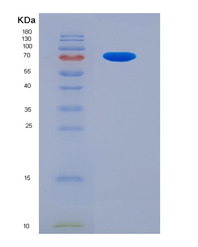 SDS-PAGE analysis of Human LGALS3BP (Galectin-3-Binding Protein) - Recombinant Protein, showing >90% purity under 15% SDS-PAGE (Reduced)