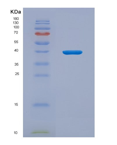 SDS-PAGE analysis of Human CD209 (Cd209 Antigen) - Recombinant Protein, showing >90% purity under 15% SDS-PAGE (Reduced)