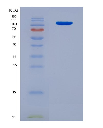 SDS-PAGE analysis of Human SEMA4D (Semaphorin-4D) - Recombinant Protein, showing >85% purity under 15% SDS-PAGE (Reduced)