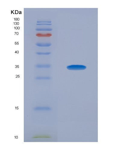 SDS-PAGE analysis of Human NOG (Noggin) - Recombinant Protein, showing >90% purity under 15% SDS-PAGE (Reduced)