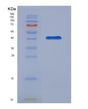 SDS-PAGE analysis of Mouse Bcan (Brevican Core Protein) - Recombinant Protein, showing >90% purity under 15% SDS-PAGE (Reduced)