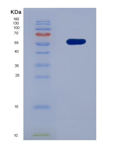 SDS-PAGE analysis of Human CD300A (Cmrf35-Like Molecule 8) - Recombinant Protein, showing >85% purity under 15% SDS-PAGE (Reduced)