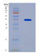 SDS-PAGE analysis of Human CSF1 (Macrophage Colony-Stimulating Factor 1) - Recombinant Protein, showing >90% purity under 15% SDS-PAGE (Reduced)
