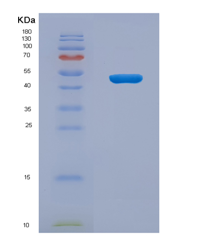 SDS-PAGE analysis of Human NSUN5 (28S Rrna (Cytosine-C(5))-Methyltransferase) - Recombinant Protein, showing >90% purity under 15% SDS-PAGE (Reduced)