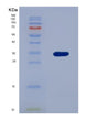 SDS-PAGE analysis of Human HSD11B1 (11-Beta-Hydroxysteroid Dehydrogenase 1) - Recombinant Protein, showing >90% purity under 15% SDS-PAGE (Reduced)